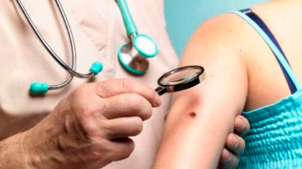 La lepra es curable si se atiende a tiempo: Epidemiólogo