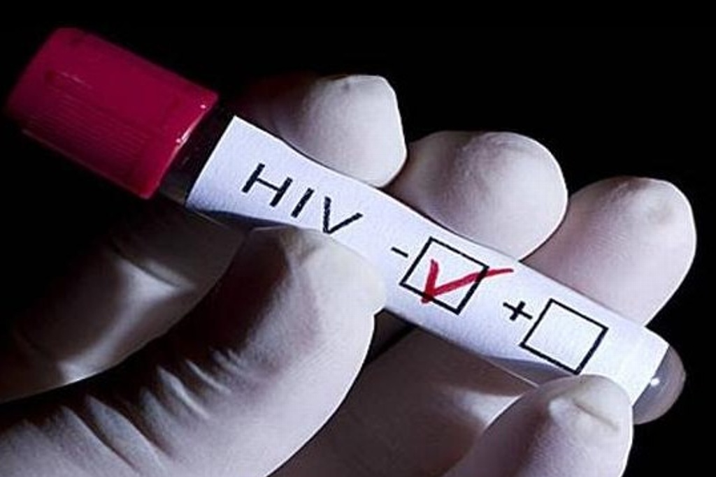 México participa en protocolo para tratamiento profiláctico de VIH